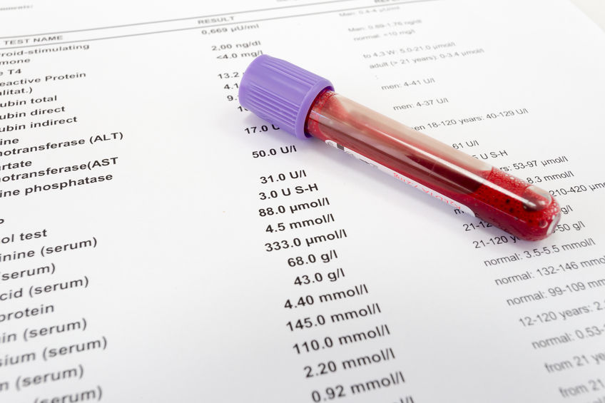 Red blood in test tube on white blank with results in colums. The results are written in English.